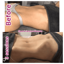 Lymphatic+Drainage+3