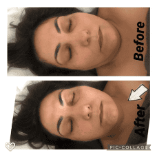 facial-lymphatic
