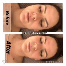 facial-lymphatic.png1